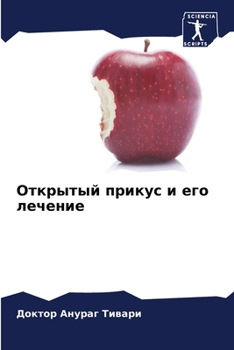 Paperback Открытый прикус и его леч [Russian] Book