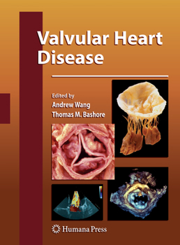 Paperback Valvular Heart Disease Book
