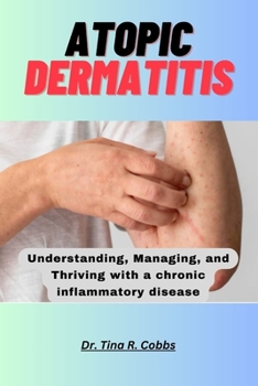 Paperback Atopic Dermatitis: Understanding, Managing, and Thriving with a chronic inflammatory disease Book