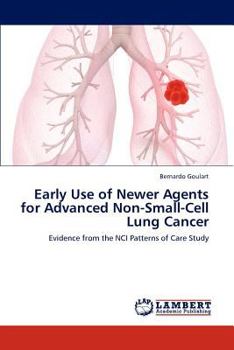 Paperback Early Use of Newer Agents for Advanced Non-Small-Cell Lung Cancer Book