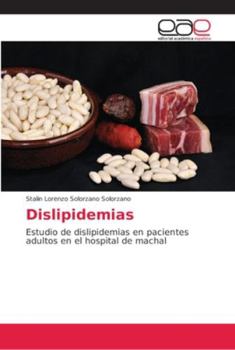 Paperback Dislipidemias [Spanish] Book