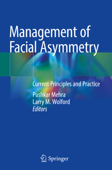 Paperback Management of Facial Asymmetry: Current Principles and Practice Book