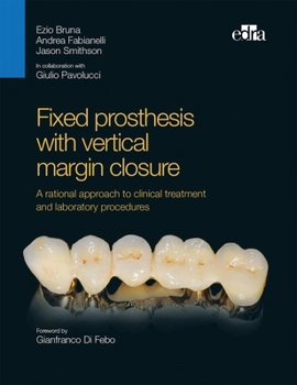 Hardcover Fixed Prosthesis with Vertical Margin Closure. a Rational Approach to Clinical Treatment and Laboratory Procedures Book