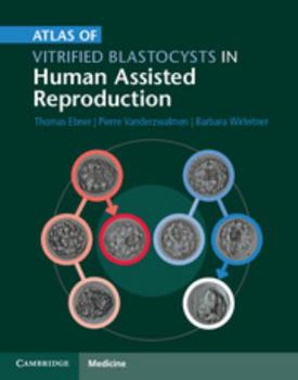 Hardcover Atlas of Vitrified Blastocysts in Human Assisted Reproduction Book