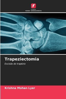 Paperback Trapeziectomia [Portuguese] Book