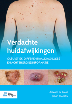 Paperback Verdachte Huidafwijkingen: Casuïstiek, Differentiaaldiagnoses En Achtergrondinformatie [Dutch] Book