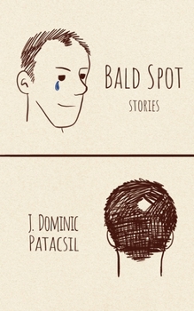 Paperback Bald Spot Book