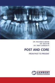 Paperback Post and Core Book