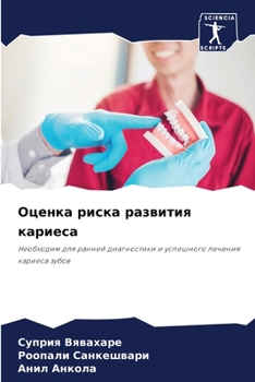 Paperback Оценка риска развития ка [Russian] Book