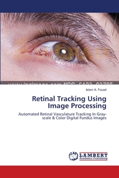 Paperback Retinal Tracking Using Image Processing Book