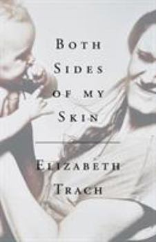 Paperback Both Sides of My Skin Book