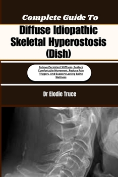 Paperback Complete Guide To Diffuse Idiopathic Skeletal Hyperostosis (Dish): Relieve Persistent Stiffness, Restore Comfortable Movement, Reduce Pain Triggers, A Book