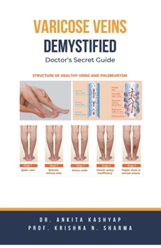 Paperback Varicose Veins Demystified: Doctor's Secret Guide Book