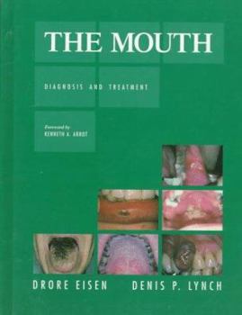 Hardcover The Mouth: Diagnosis and Treatment Book