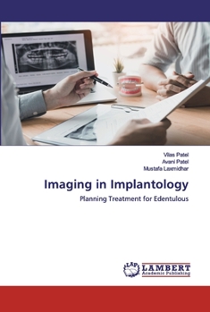 Paperback Imaging in Implantology Book