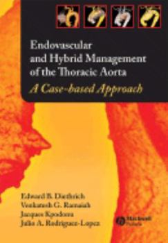 Hardcover Endovascular and Hybrid Management of the Thoracic Aorta: A Case-Based Approach Book