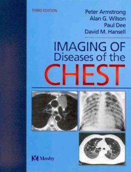 Hardcover Imaging of Diseases of the Chest Book