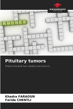 Paperback Pituitary tumors Book