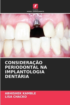 Paperback Consideração Periodontal Na Implantologia Dentária [Portuguese] Book