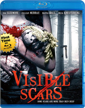 Visible Scars