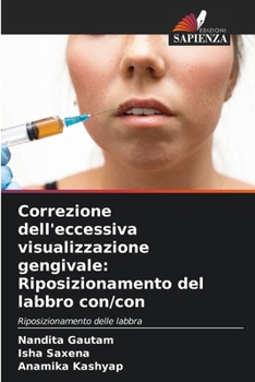 Paperback Correzione dell'eccessiva visualizzazione gengivale: Riposizionamento del labbro con/con [Italian] Book