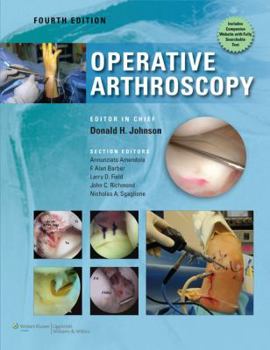 Hardcover Operative Arthroscopy Book