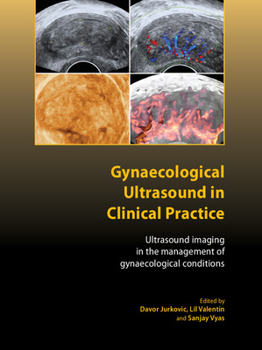 Gynaecological Ultrasound In Clinical Practice: Ultrasound Imaging In The Management Of Gynaecological Conditions - Book  of the Royal College of Obstetricians and Gynaecologists Advanced Skills