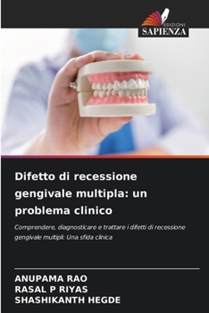 Paperback Difetto di recessione gengivale multipla: un problema clinico [Italian] Book