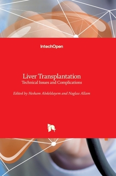 Hardcover Liver Transplantation: Technical Issues and Complications Book