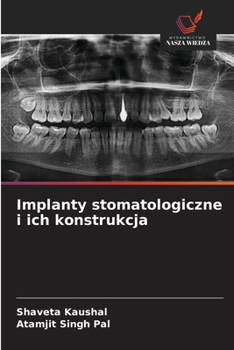 Implanty stomatologiczne i ich konstrukcja (Polish Edition)