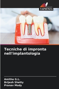 Paperback Tecniche di impronta nell'implantologia [Italian] Book