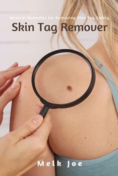 Paperback Skin Tag Remover: Natural Remedies for Removing Skin Tag Safely Book