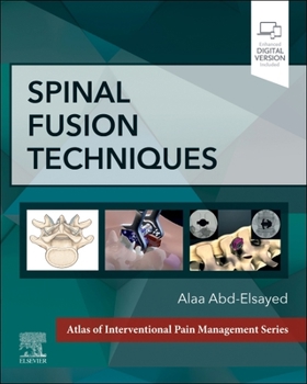 Hardcover Spinal Fusion Techniques Book