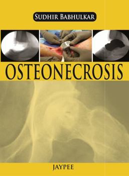 Paperback Osteonecrosis Book