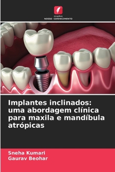 Implantes inclinados: uma abordagem clínica para maxila e mandíbula atrópicas (Portuguese Edition)