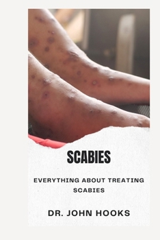 Paperback Scabies: Everything about Treating Scabies Book