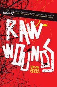 Paperback Raw Wounds Book