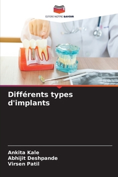 Paperback Différents types d'implants [French] Book