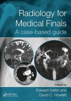 Paperback Radiology for Medical Finals: A Case-Based Guide Book