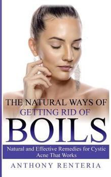 Paperback The Natural Ways of Getting Rid of Boils: Natural and Effective Remedies for Cystic Acne that Works Book