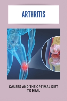 Paperback Arthritis: Causes And The Optimal Diet To Heal: What Vegetables Are Bad For Arthritis Book