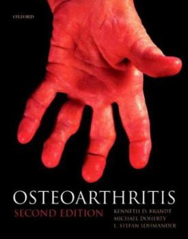 Hardcover Osteoarthritis (Oxford Medical Publications) Book
