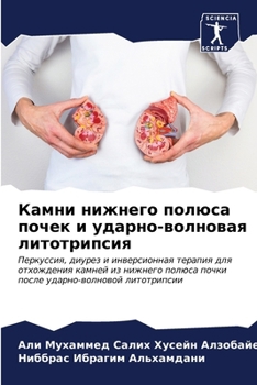 Paperback Камни нижнего полюса поч [Russian] Book