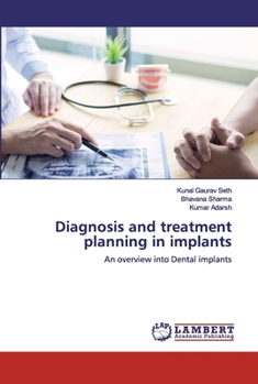 Paperback Diagnosis and treatment planning in implants Book