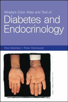 Paperback Mosby's Color Atlas and Text of Diabetes and Endocrinology Book