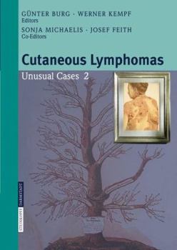 Paperback Cutaneous Lymphomas: Unusual Cases 2 Book