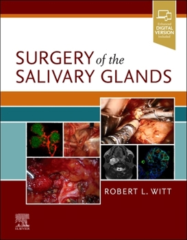 Hardcover Surgery of the Salivary Glands Book