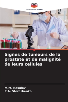 Paperback Signes de tumeurs de la prostate et de malignité de leurs cellules [French] Book