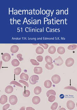 Paperback Haematology and the Asian Patient: 51 Clinical Cases Book