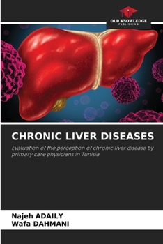 Paperback Chronic Liver Diseases Book